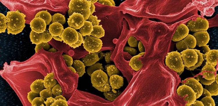 Mucus And The Meaning Of Different Colours
